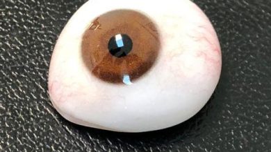 بازسازی چهره و پیشگیری از عوارض پس از تخلیه چشم با پروتزهای چشمی پیشرفته