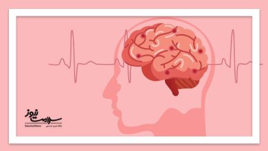 سکته مغزی ایرانی‌ها را بیشتر می‌کشد؛ سن بروز ۱۰ سال زودتر از متوسط جهانی