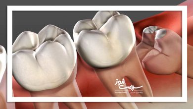 دندان عقل بی فایده یا ارزشمند؟