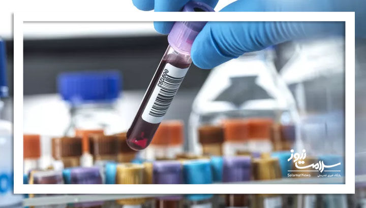 آزمایش خون کلراید چیست؟