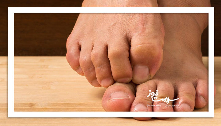 بی‌حسی پاها از زانو به پایین؛ زنگ خطری برای سلامت عصبی و عروقی