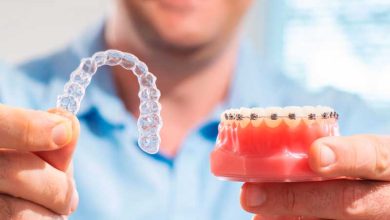 تفاوت بین ارتودنسی معمولی (با نگین و سیم) و ارتودنسی نامرئی