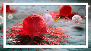 آیا افزایش سرطان‌های زودهنگام فقط نتیجه غربالگری بیشتر است؟