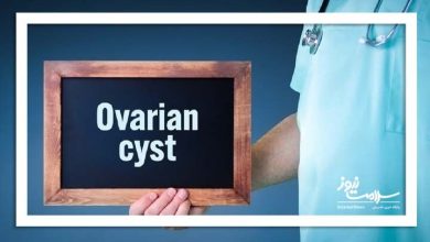 کیست تخمدان؛ شایع اما غالباً بی‌خطر در زنان بارور