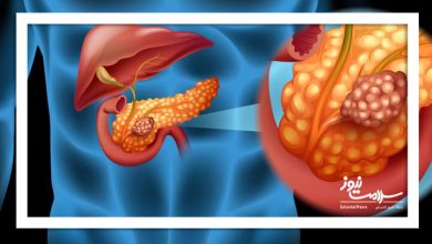 شناسایی علامت هشدار دهنده اولیه سرطان پانکراس، معروف به «قاتل خاموش