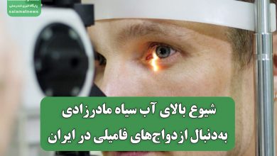 شیوع بالای آب سیاه مادرزادی به‌دنبال ازدواج‌های فامیلی در ایران