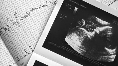 غربالگری در کشور ممنوع نیست و همچنان انجام می‌شود