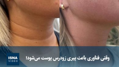 ویدیو/ وقتی فناوری باعث پیری زودرس پوست می‌شود!