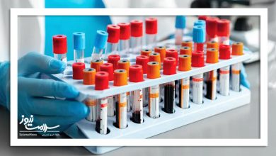 چه زمانی آزمایش خون ضروری است؟