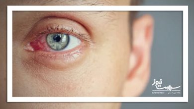 روش های کنترل خشکی چشم در زمستان