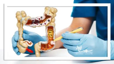 عوامل اصلی رشد سرطان‌های گوارشی در ایران،مصرف الکل و دخانیات متهم شماره یک