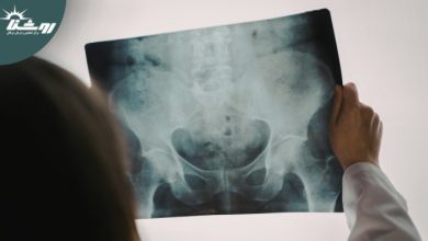 چرا برخی دردهای لگنی هرگز نباید نادیده گرفته شوند؟