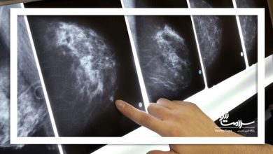 تغییر سبک زندگی راهکار غلبه بر سرطان/ماموگرافی، نقش کلیدی در تشخیص زودهنگام سرطان پستان