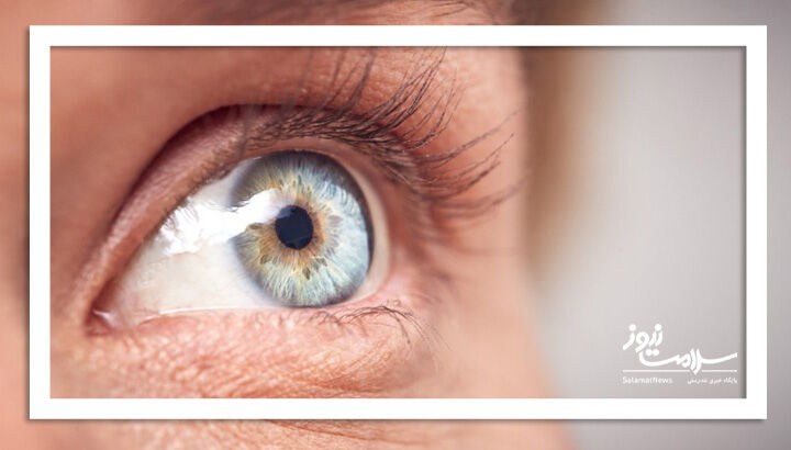 تهدیدات سلامت چشمی را بشناسید