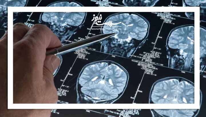 سرطان‌های شایع در ایران کدامند؟