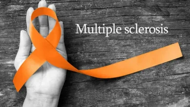 جهش ۳۰ درصدی مراجعه بیماران ام‌اس به مراکز درمانی در جنگ/ ۱۲۰ هزار بیمار ام‌اس در کشور؛ سهم بالای زنان