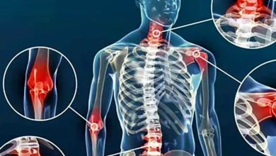 چرا درد مفاصل در بهار تشدید می شود؟