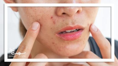 رفع جوش‌های صورت با کمک ماسک خانگی