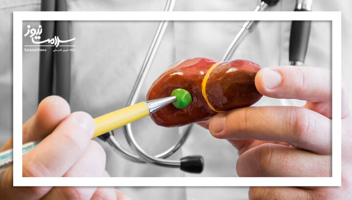 چه زمانی نیاز به بررسی سنگ کیسه صفرا داریم؟