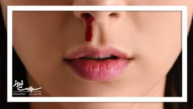 چگونه خون دماغ را بند بیاوریم؟