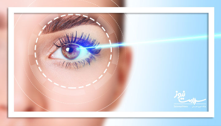 بهترین زمان برای لیزیک کردن چشم