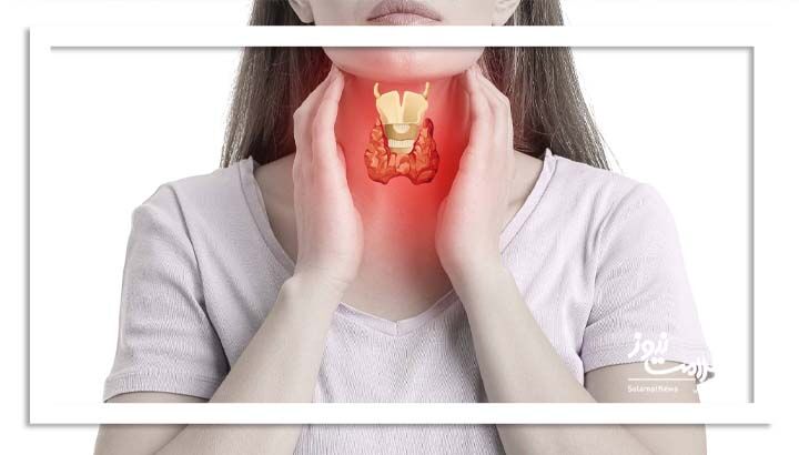 بیماران تیروئیدی به این توصیه توجه کنند