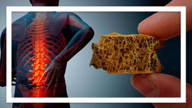 چگونه مانع پوک شدن استخوانها شویم؟