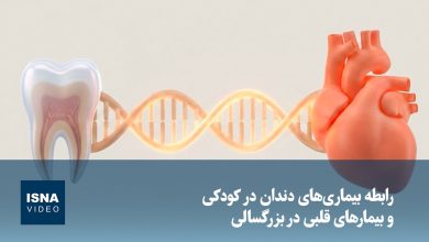 ویدیو/ رابطه بیماری‌های دندان در کودکی و بیمارهای قلبی در بزرگسالی